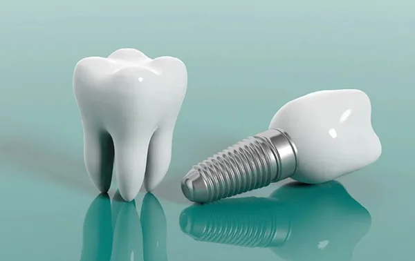 IMPLANTS