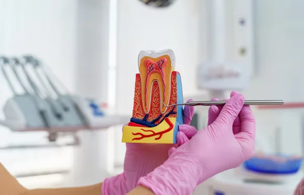 PAINLESS RCT