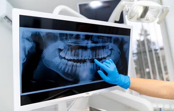 DIGITAL X RAY
