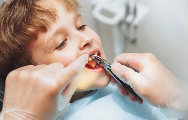 PAINLESS EXTRACTIONS